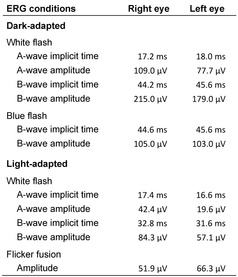 Gyrate atrophy-like phenotype with normal plasma ornithine and low plasma taurine.