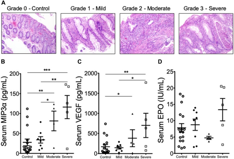 Markers of Hypoxia Correlate with Histologic and Endoscopic Severity of Colitis in Inflammatory Bowel Disease.