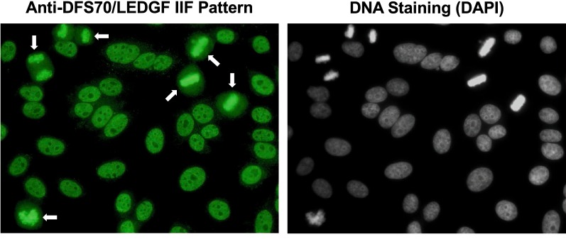 Twenty years of research on the DFS70/LEDGF autoantibody-autoantigen system: many lessons learned but still many questions.