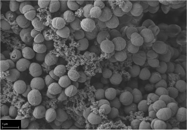 Sphingosine is able to prevent and eliminate Staphylococcus epidermidis biofilm formation on different orthopedic implant materials in vitro.