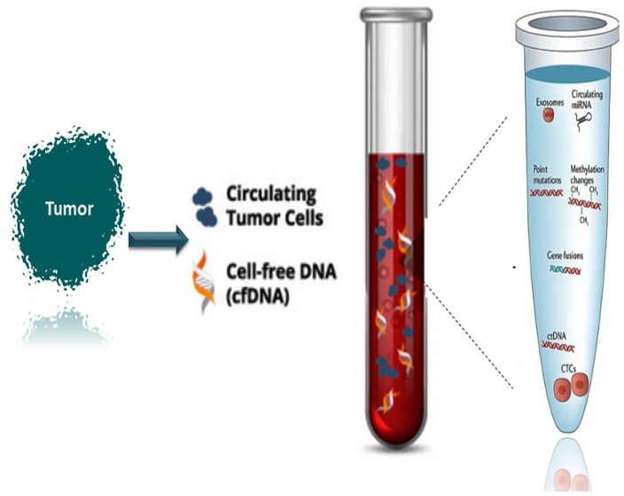 Liquid Biopsy: The Unique Test for Chasing the Genetics of Solid Tumors.