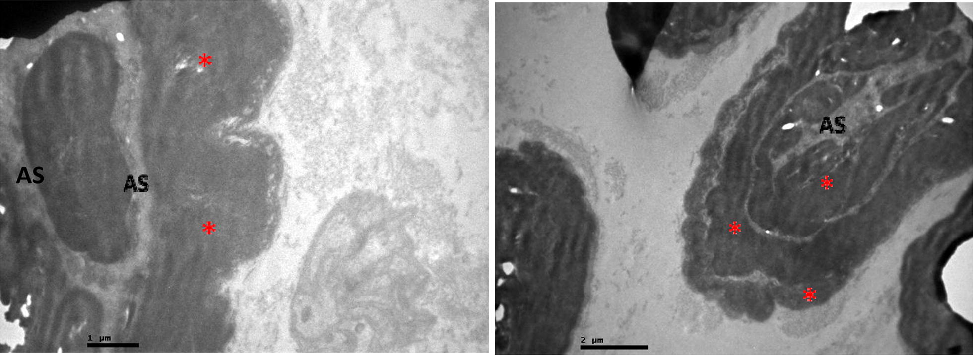 Histologic evaluation of femoral nerve demyelinating and axonal neuropathy in Wistar rats due to alendronate intake: a randomised study.