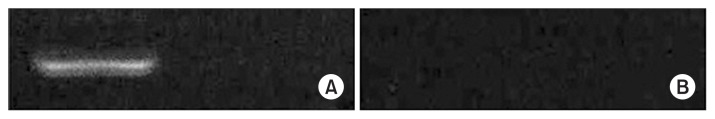 Relationship between Cancer Stem Cell Marker CD133 and Cancer Germline Antigen Genes in NCI-H292 Lung Cancer Cells.