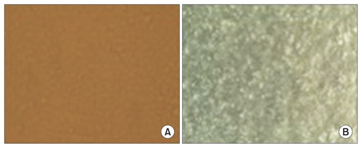 Relationship between Cancer Stem Cell Marker CD133 and Cancer Germline Antigen Genes in NCI-H292 Lung Cancer Cells.