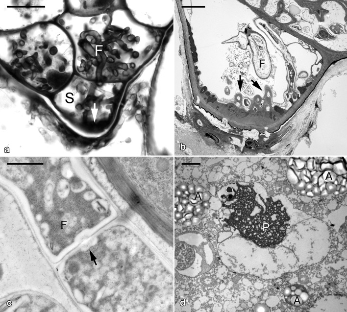 Ultrastructural changes during the symbiotic seed germination of Gastrodia elata with fungi, with emphasis on the fungal colonization region.