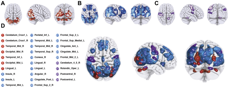 Inhibition-Related Cortical Hypoconnectivity as a Candidate Vulnerability Marker for Obsessive-Compulsive Disorder.