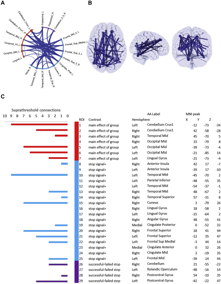 Inhibition-Related Cortical Hypoconnectivity as a Candidate Vulnerability Marker for Obsessive-Compulsive Disorder.