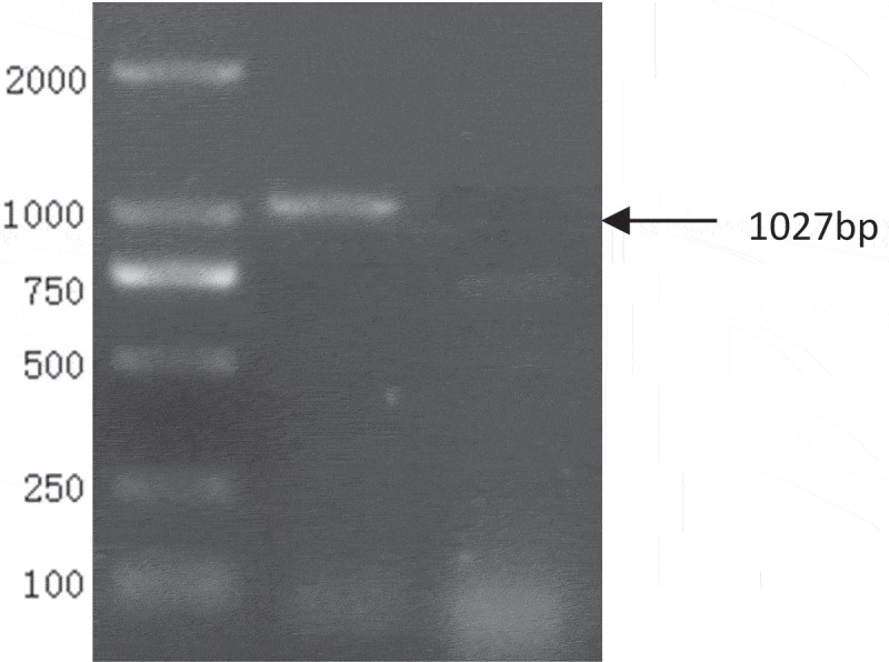 Detection of the epidemic of the H3N8 subtype of the equine influenza virus in large-scale donkey farms.