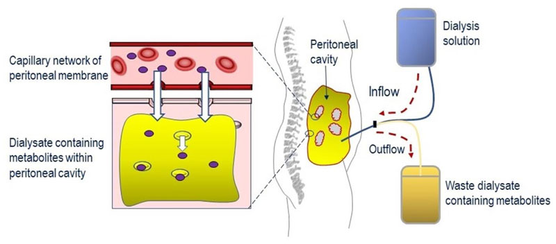 Mitochondrial neurogastrointestinal encephalomyopathy: approaches to diagnosis and treatment.