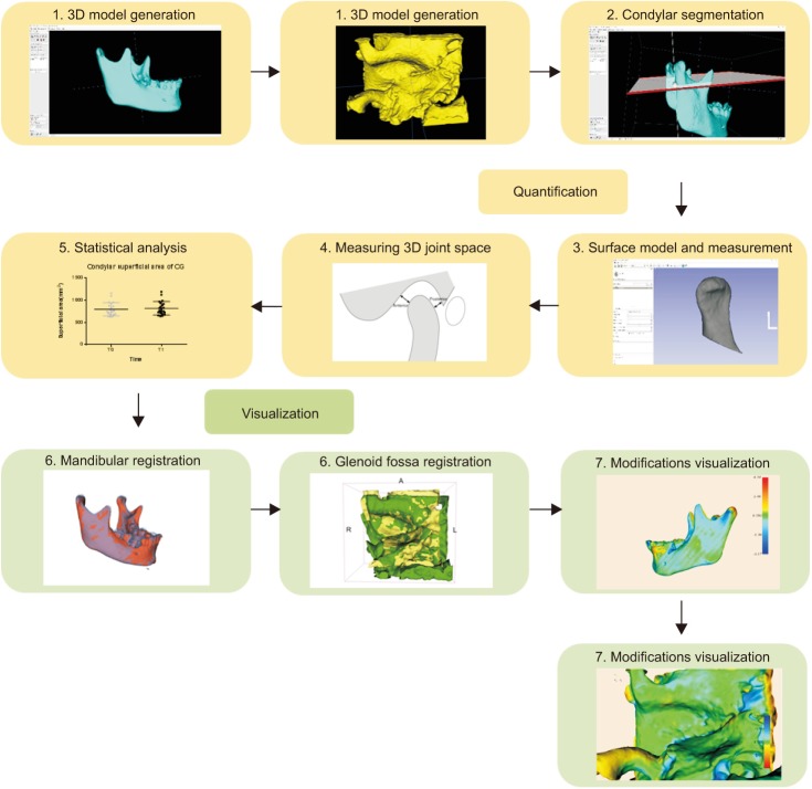 Three-dimensional cone beam computed tomography analysis of temporomandibular joint response to the Twin-block functional appliance.