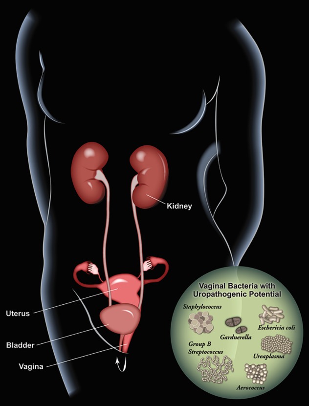 Roles of the vagina and the vaginal microbiota in urinary tract infection: evidence from clinical correlations and experimental models.