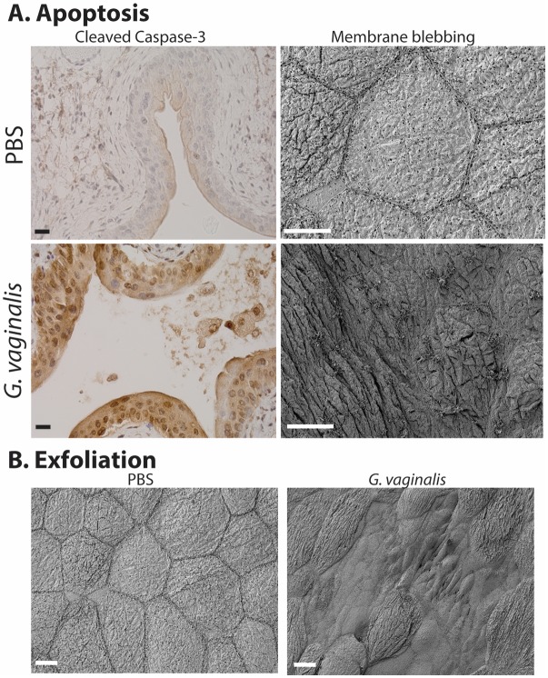 Roles of the vagina and the vaginal microbiota in urinary tract infection: evidence from clinical correlations and experimental models.