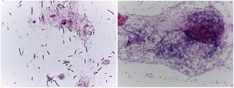 Roles of the vagina and the vaginal microbiota in urinary tract infection: evidence from clinical correlations and experimental models.