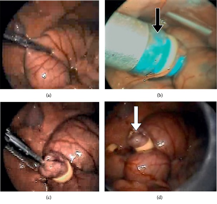 Does Helium Pneumoperitoneum Reduce the Hyperinflammatory Response in Septic Animals during Laparoscopy?