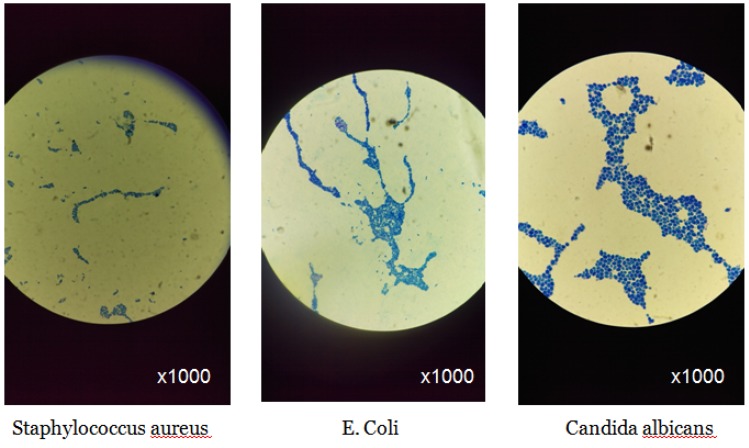 Development and Study of Biocompatible Polyurethane-Based Polymer-Metallic Nanocomposites.