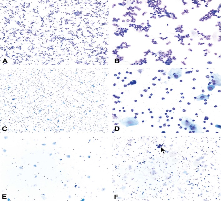 Staging of the estrous cycle and induction of estrus in experimental rodents: an update.