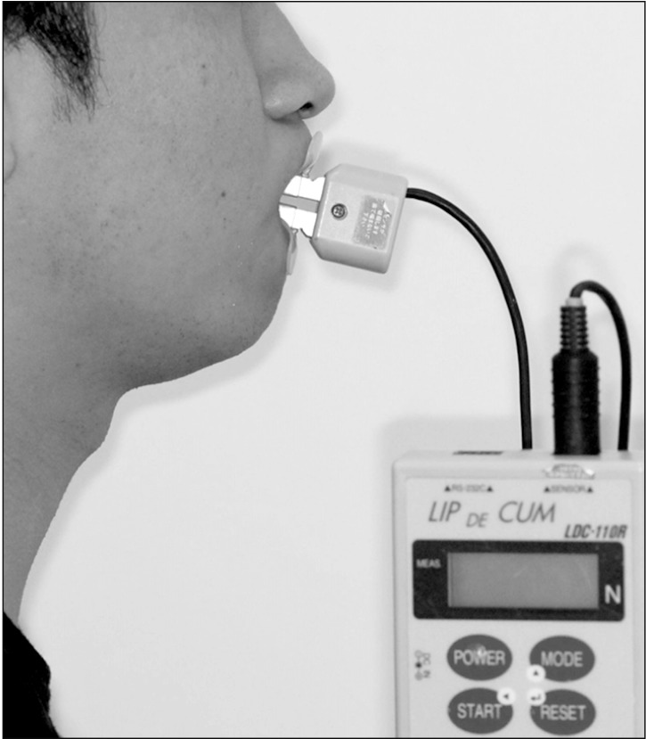 Changes in maximum lip-closing force after extraction and nonextraction orthodontic treatments.