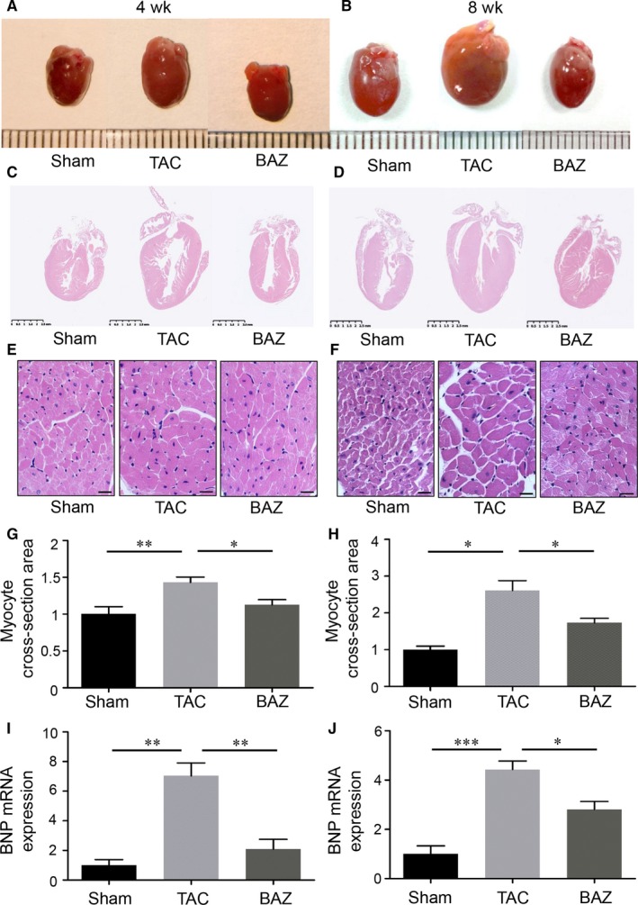 Inhibition of Interleukin-6/glycoprotein 130 signalling by Bazedoxifene ameliorates cardiac remodelling in pressure overload mice.