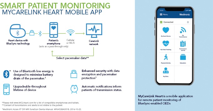 The Use of App-based Follow-up of Cardiac Implantable Electronic Devices.