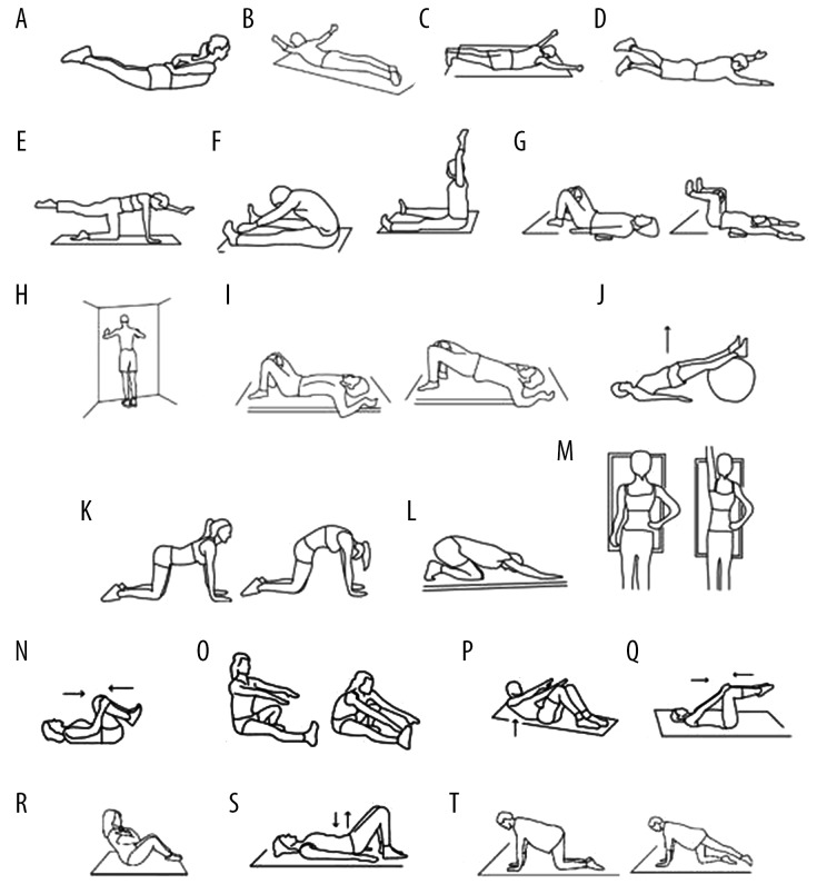 Outcome of 24 Weeks of Combined Schroth and Pilates Exercises on Cobb Angle, Angle of Trunk Rotation, Chest Expansion, Flexibility and Quality of Life in Adolescents with Idiopathic Scoliosis.