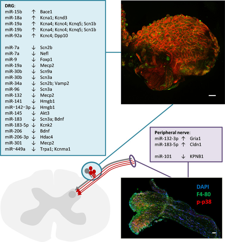 Non-coding RNAs in neuropathic pain.