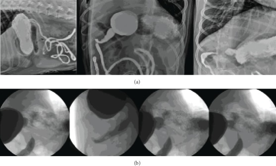 Benign Duodenal Stricture Treated with Surgical Correction and Dietary Therapy in a Golden Retriever.