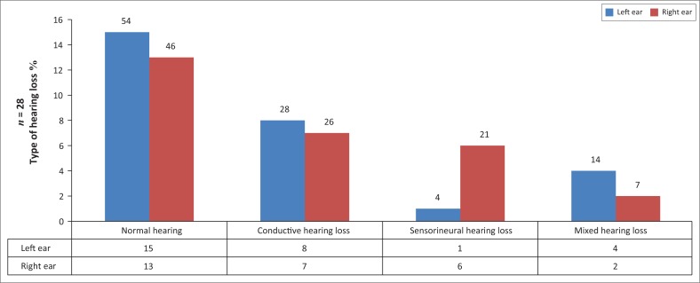 An audiological profile of a cohort of school-aged children with HIV and AIDS attending an antiretroviral clinic in South Africa.