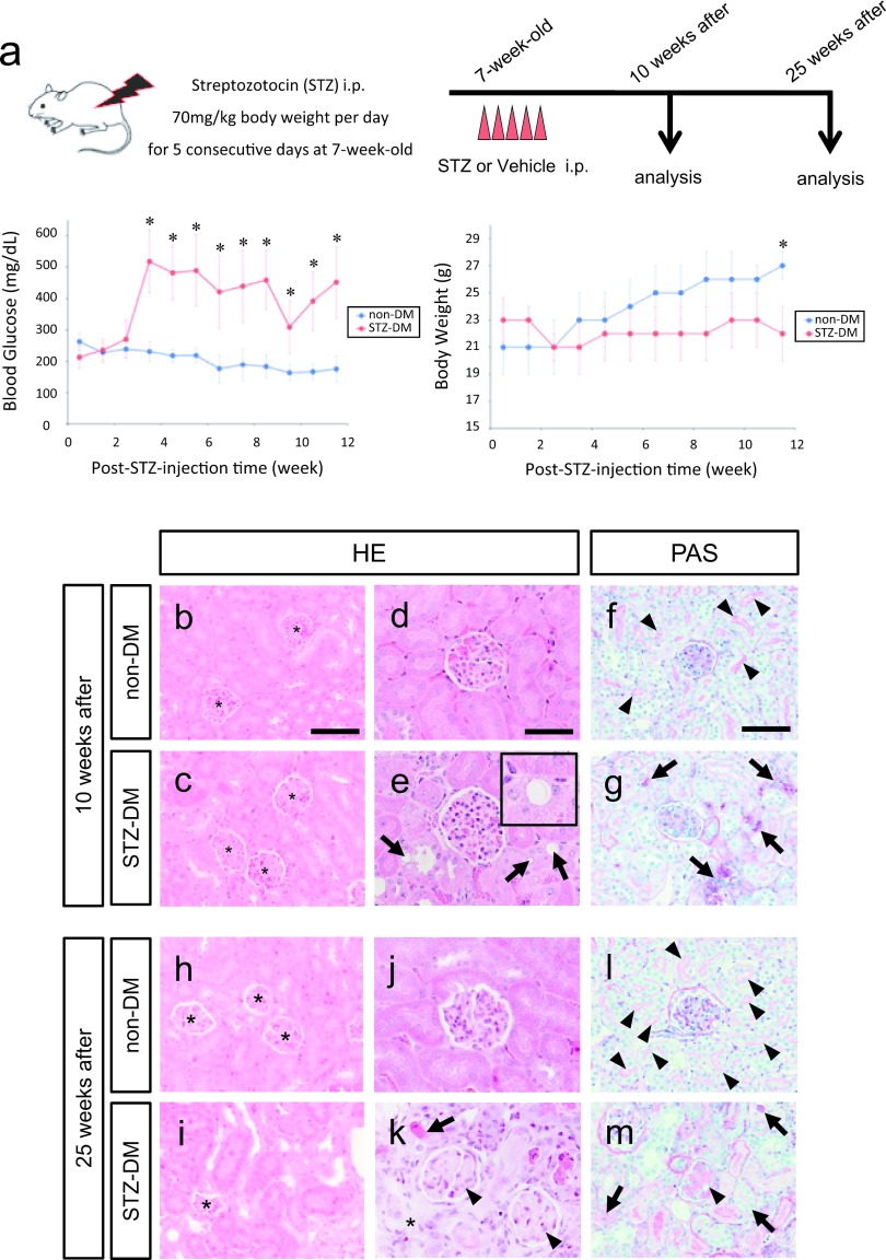 New Insights into the Pathogenesis of Diabetic Nephropathy: Proximal Renal Tubules Are Primary Target of Oxidative Stress in Diabetic Kidney.