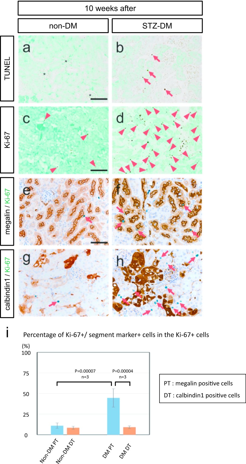 New Insights into the Pathogenesis of Diabetic Nephropathy: Proximal Renal Tubules Are Primary Target of Oxidative Stress in Diabetic Kidney.