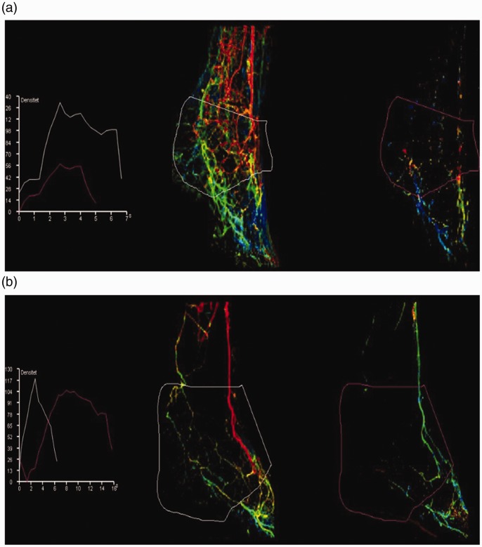 2D perfusion-angiography during endovascular intervention for critical limb threatening ischemia - A feasibility study.