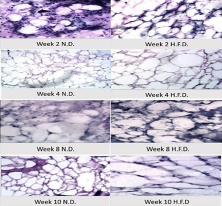 Expression profiling and analysis of some miRNAs in subcutaneous white adipose tissue during development of obesity.