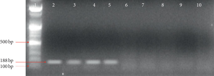 Evaluation of Actin-1 Expression in Wild Caught <i>Wuchereria bancrofti</i>-Infected Mosquito Vectors.