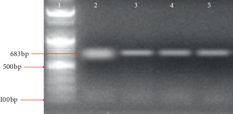 Evaluation of Actin-1 Expression in Wild Caught <i>Wuchereria bancrofti</i>-Infected Mosquito Vectors.