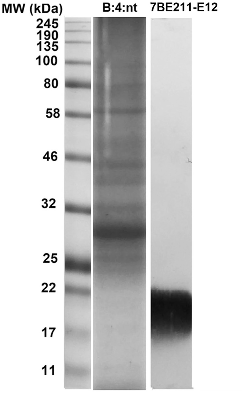 <i>Neisseria meningitidis</i>: analysis of pili and LPS in emerging Brazilian strains.