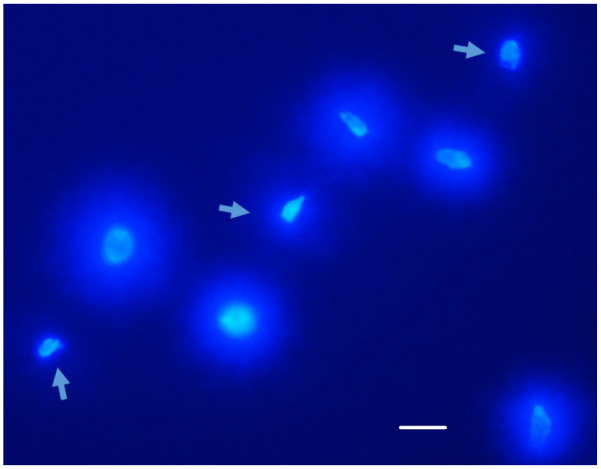 Studies on the basic issues relevant to sperm cryopreservation in humans.