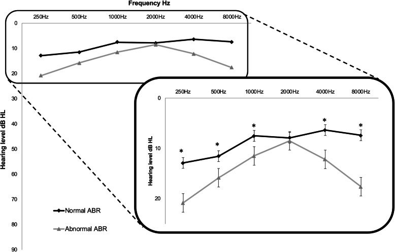 Vestibular impact of Friedreich ataxia in early onset patients.