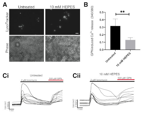 Detrimental effect of zwitterionic buffers on lysosomal homeostasis in cell lines and iPSC-derived neurons.