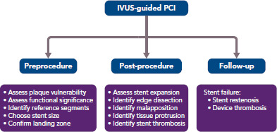 Intravascular Ultrasound-guided Versus Angiography-guided Percutaneous Coronary Intervention: Evidence from Observational Studies and Randomized Controlled Trials.