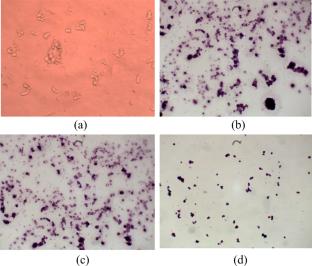 The effect of ultrasound hyperthermia with gold nanoparticles on retinoblastoma Y79 cells