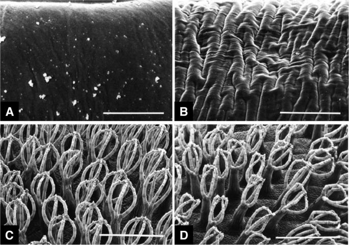 Methanol fixation for scanning electron microscopy of plants