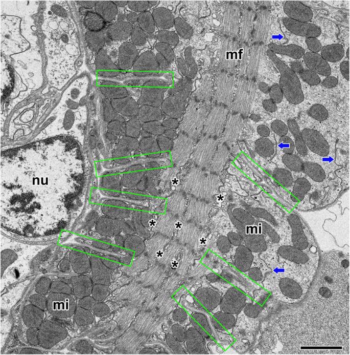 Fine structure of the cardiac muscle cells in the orb-web spider Nephila clavata