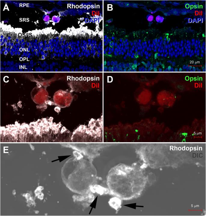 Light microscopic evidence of in vivo differentiation from the transplanted inferior turbinate-derived stem cell into the rod photoreceptor in degenerating retina of the mouse