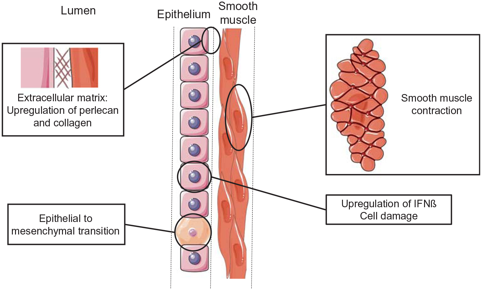 Picornavirus Cellular Remodeling: Doubling Down in Response to Viral-Induced Inflammation.