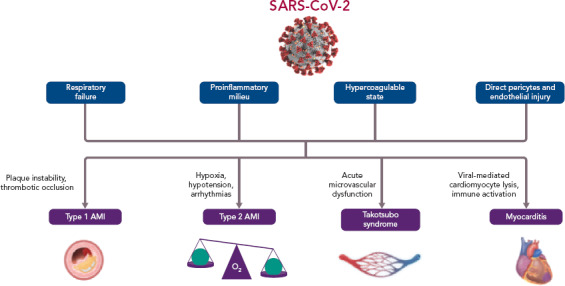 Myocardial and Microvascular Injury Due to Coronavirus Disease 2019.