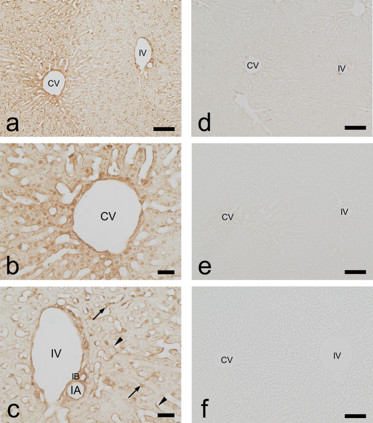 Immunohistochemical Pharmacokinetics of the Anti-diabetes Drug Alogliptin in Rat Kidney and Liver.