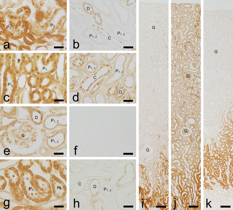 Immunohistochemical Pharmacokinetics of the Anti-diabetes Drug Alogliptin in Rat Kidney and Liver.