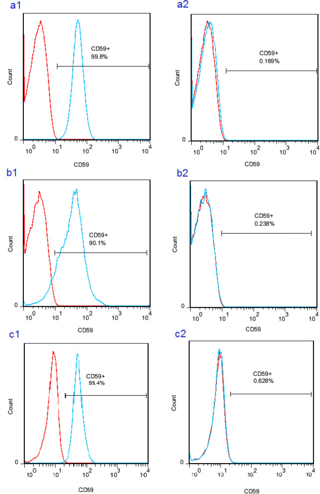 Recurrent angioedema, Guillain-Barré, and myelitis in a girl with systemic lupus erythematosus and CD59 deficiency syndrome.