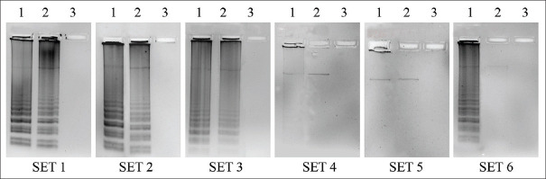 Detection of epidermal growth factor receptor T790M mutation by allele-specific loop mediated isothermal amplification.