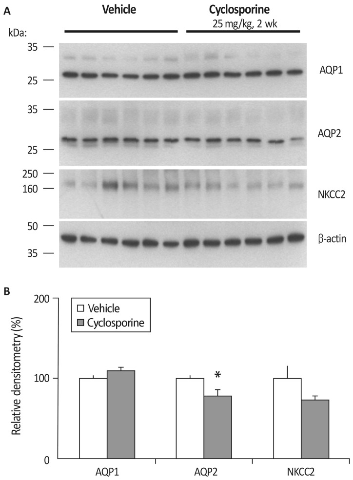 Urinary Concentration Defect and Renal Glycosuria in Cyclosporine-treated Rats.