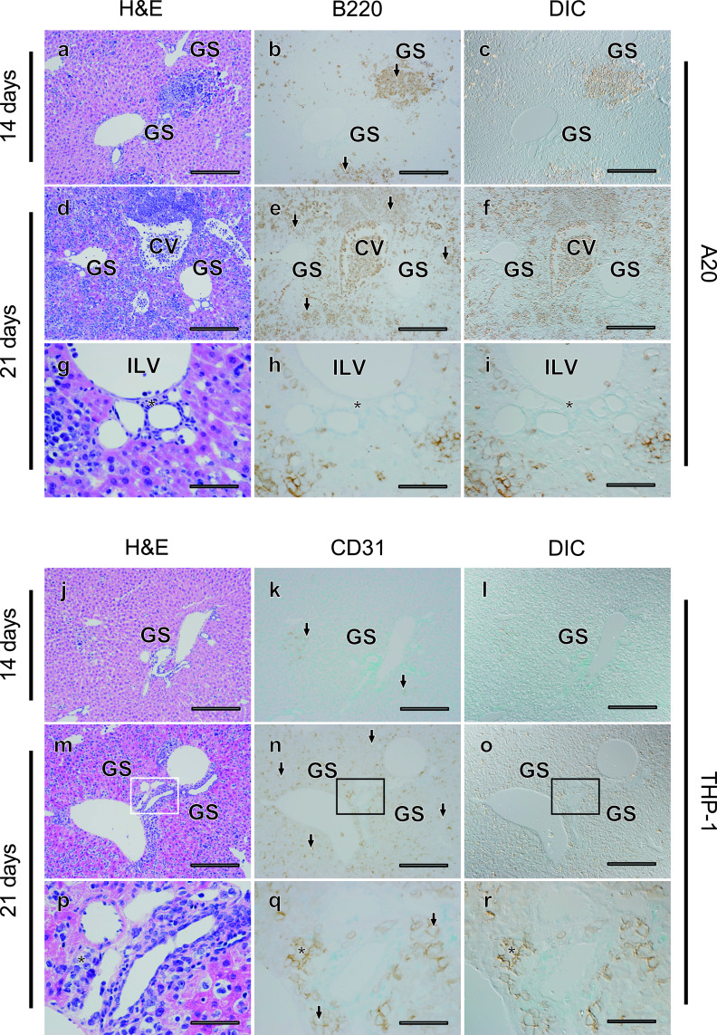 Differential Localization and Invasion of Tumor Cells in Mouse Models of Human and Murine Leukemias.